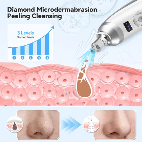 Protable Diamond Microdermabrasion Machine Handheld Blackhead Removal Facial Skin Care Beauty Device for Acne Scars