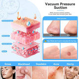 Protable Diamond Microdermabrasion Machine Handheld Blackhead Removal Facial Skin Care Beauty Device for Acne Scars