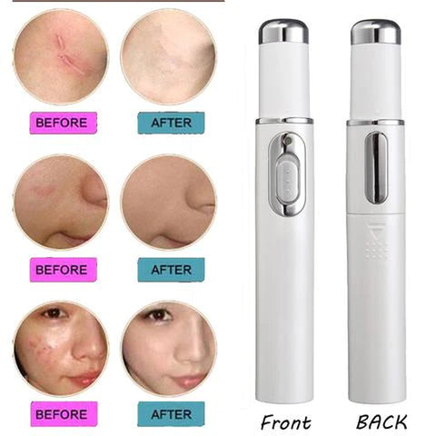 Skincare Beauty Pen | Wrinkle Removal Treatment Device